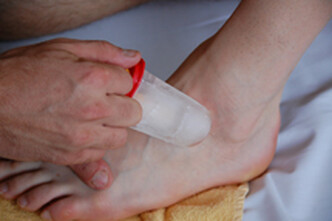 Bild zeigt eine Behandlung mit Eis am Fuß